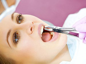 Особенности и возможности для удаления зубов