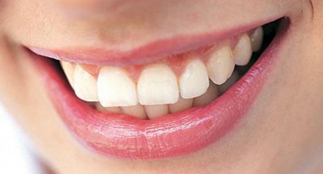 Особенности одномоментной имплантации зубов